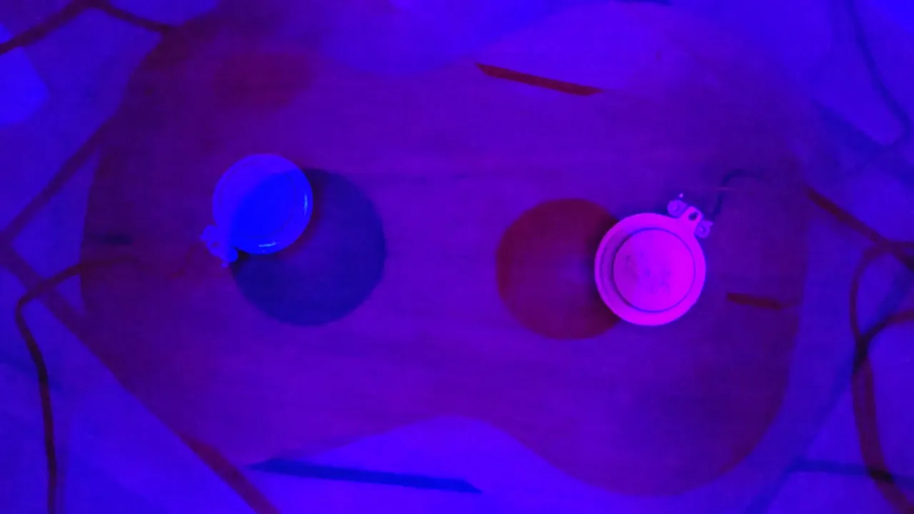 Preview image of Cross-Dimensional Lung Transplant